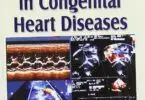 Step by Step Echocardiography in Congenital Heart Diseases
