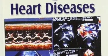 Step by Step Echocardiography in Congenital Heart Diseases