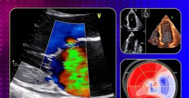 Echocardiography: A Practical Guide for Reporting and Interpretation