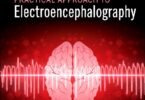 Practical Approach to Electroencephalography