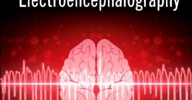 Practical Approach to Electroencephalography