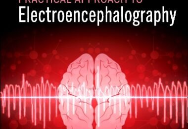 Practical Approach to Electroencephalography